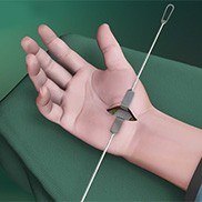 Carpal Tunnel Release Surgery