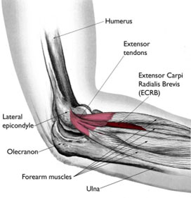 Ulnar Nerve Subluxation