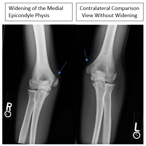 Hand and finger injuries - WikEM