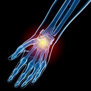 Sports Injuries of the Hand, Wrist and Elbow